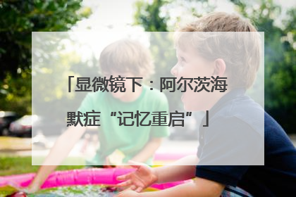 显微镜下：阿尔茨海默症“记忆重启”